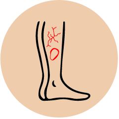 logo whiteAsset 4 Icon for representing Ulcer