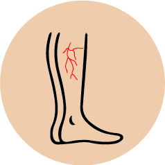 logo whiteAsset 7 Icon Representing varicose and spider veins